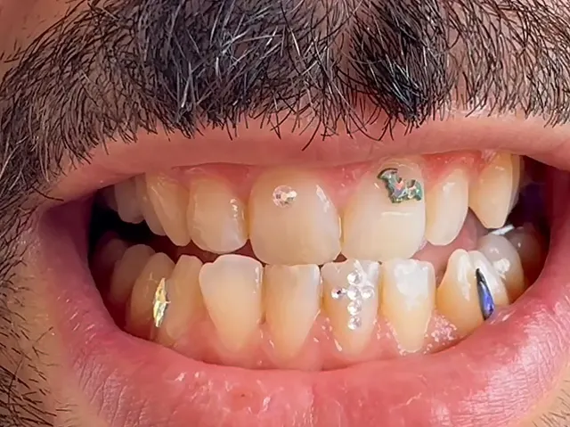 Sonrisa de frente con todas las piezas: cristales, murciélago, cruz y gota